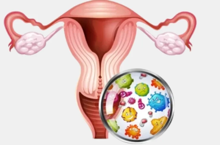 Gynecological-Infections-STDs-0.webp